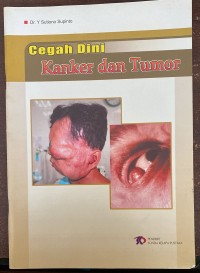 Image of Cegah Dini Kanker dan Tumor